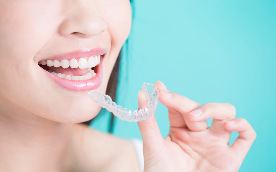 Cómo limpiar la ortodoncia Invisalign